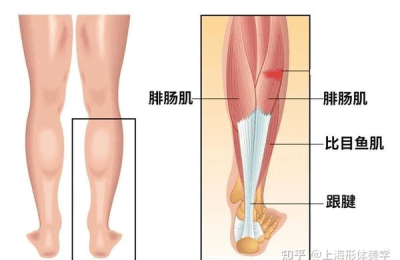 小腿肌肉打瘦腿针有效果吗 