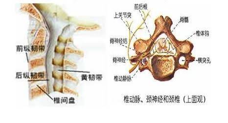 怎么治疗颈椎病最好 