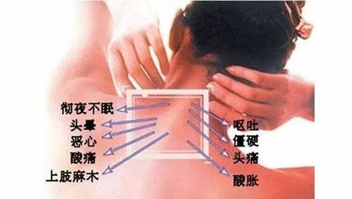 颈椎病眩晕挂什么科黑马词 